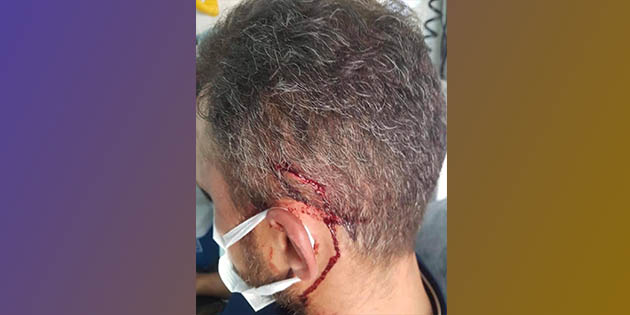 Yolağzı İHO Müdür Yardımcısı, veli saldırısına uğradı, kanlar içinde kaldı…