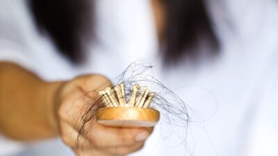 Dünya çapında 56 milyon insan, saç dökülmesi sorunuyla mücadele ediyor.