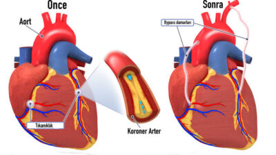 Medical Point Gaziantep Hastanesi Kalp ve Damar Cerrahisi Uzmanı Prof.