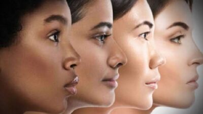 ABD'de bilim insanlarınca yapılan araştırmada, insanlara cilt rengini veren pigmentasyonla