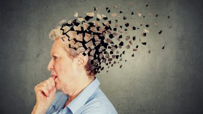 Alzheimer hastalığı, beynin küçülmesine yol açarak bunama ve beyin fonksiyonlarının