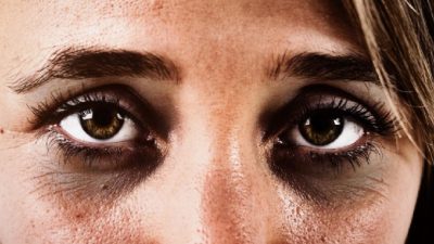 “Göz altı morlukları Nasıl Geçer?” diye düşünüyorsanız evde bazı değişiklikler