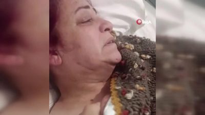 Yasaklı cins köpeklerin saldırısına uğrayan kadın, aylar geçmesine rağmen her