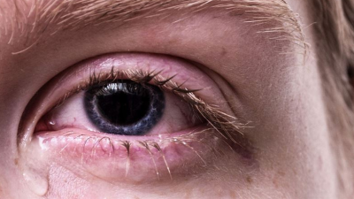 Medipol Mega Üniversite Hastanesi Göz Sağlığı ve Hastalıkları Bölümü'nden Doç.