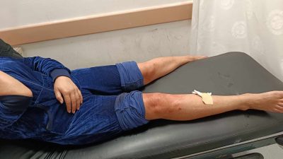 Hatay’ın Samandağ ilçesinde sahipsiz köpeklerin saldırısına uğrayan kadın yaralandı. Deniz