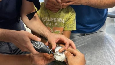 Hatay’ın İskenderun ilçesinde, 9 yaşındaki çocuğun parmağına sıkışan demir parça