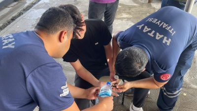 Hatay’ın Antakya ilçesinde bir vatandaşın parmağına sıkışan yüzük, itfaiye ekiplerinin