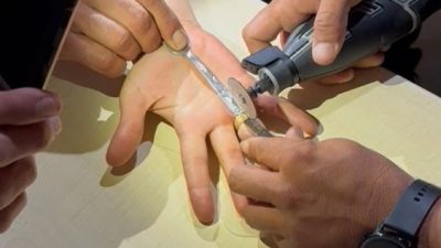 Hatay’ın Yayladağı ilçesinde parmağına yüzük sıkışan vatandaşın imdadına itfaiye ekipleri