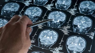 Michigan Üniversitesi’nde Yapılan Araştırma Ölüm Anındaki Beyin Aktivitesini İnceliyor