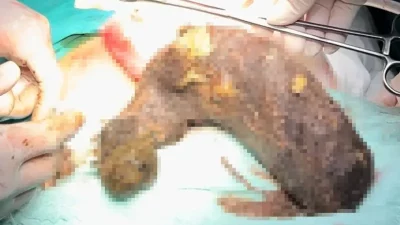 Hatay’ın İskenderun ilçesinde yaşayan 20 yaşındaki Ö.A, şiddetli karın ağrısı