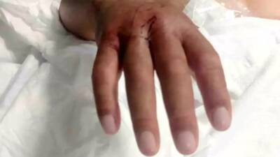 Hatay’ın Dörtyol ilçesinde narenciye hasadı sırasında yılan sokan çiftçi Gani