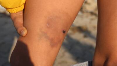 Hatay’ın Kırıkhan ilçesinde geçtiğimiz günlerde yaşanan korkunç olayda, kuduz olduğu