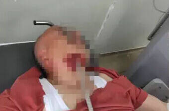 Hatay’ın İskenderun ilçesinde yaşanan iş kazasında, bir inşaat işçisinin yüzüne