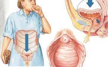 Prof. Dr. Murat Ekin: “İlerlemiş vakalarda cerrahi yöntemlerle kalıcı çözüm
