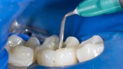 Kötü ağız hijyeni, diş hekimi kontrollerinin ihmal edilmesi ve şekerli-asitli