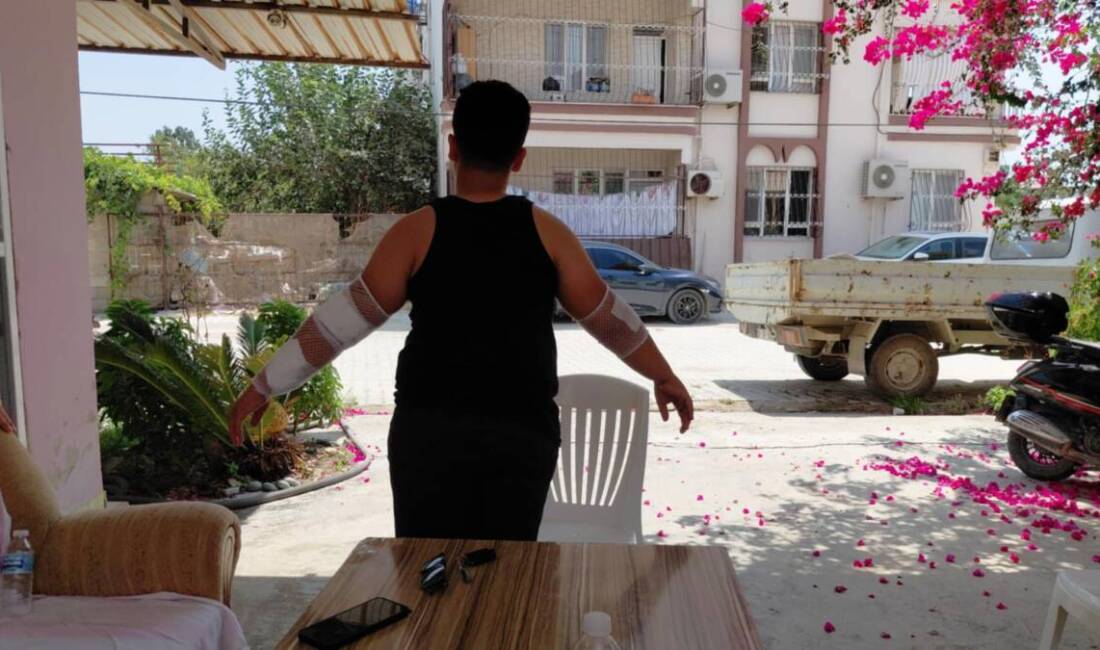 Hatay’ın Samandağ ilçesinde, sahipsiz bir köpeğin saldırısına uğrayan 10 yaşındaki