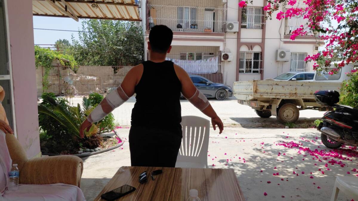 Hatay’ın Samandağ ilçesinde, sahipsiz bir köpeğin saldırısına uğrayan 10 yaşındaki