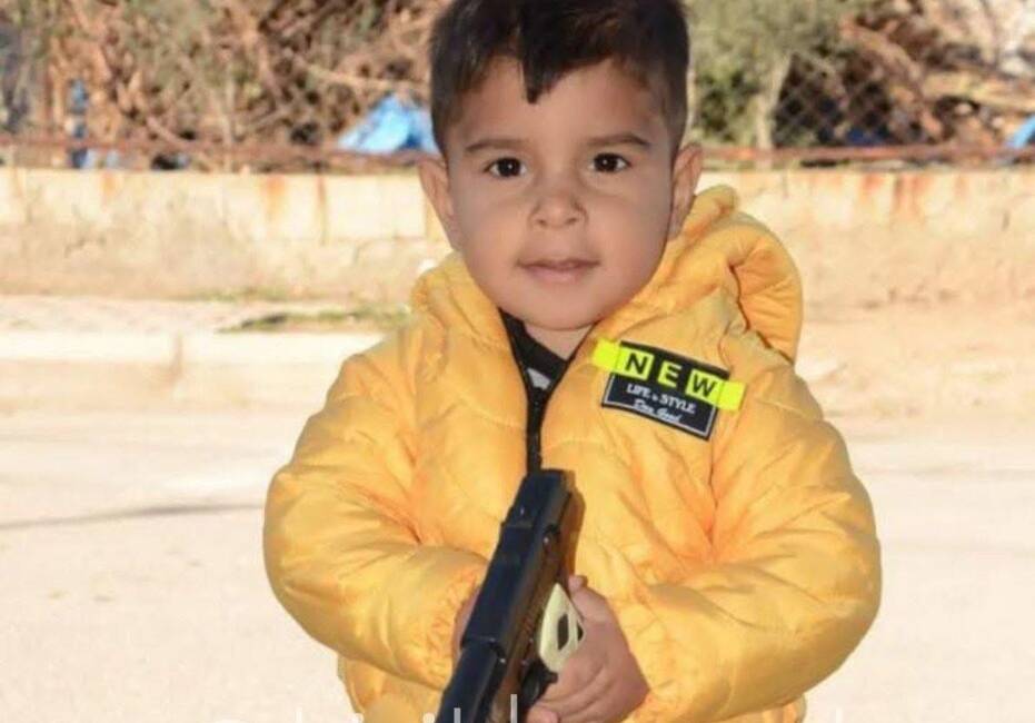 Hatay’ın Kırıkhan ilçesinde geçtiğimiz hafta evde çıkan yangında ağır yaralanan