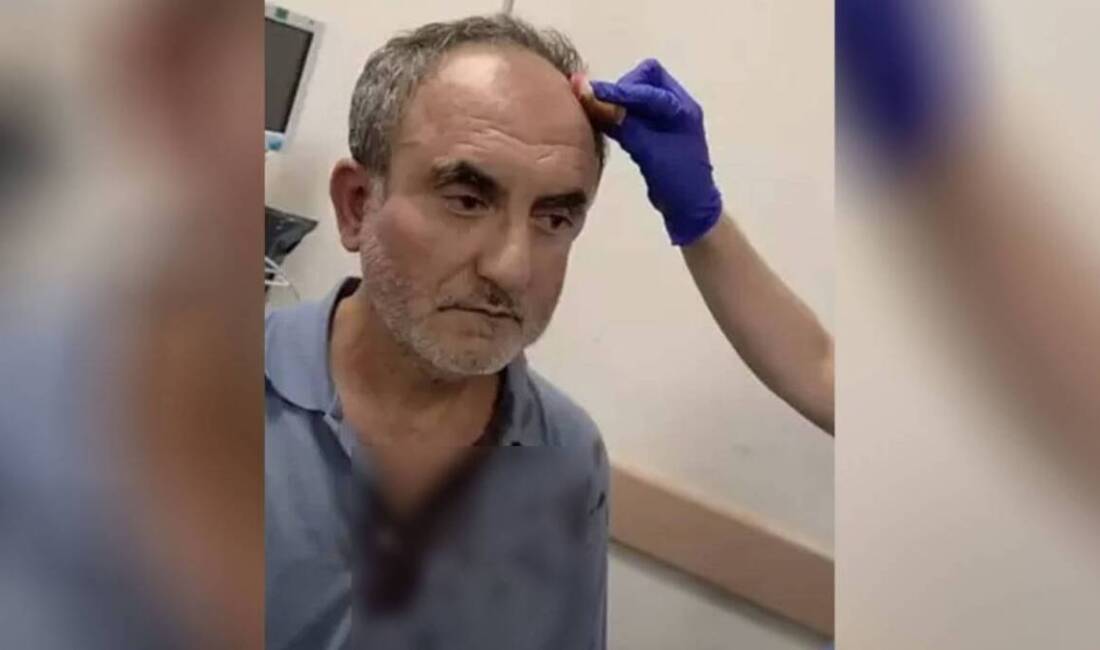 Samandağ Ekoloji Grubu Sözcüsü saldırıya uğradı Hatay’ın Samandağ ilçesinde, mahkeme kararıyla faaliyeti durdurulan beton santralının ortağı,