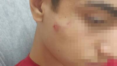 Hatay’da okuldan döndüğü esnada aynı okulda okuduğu akranı tarafından demir