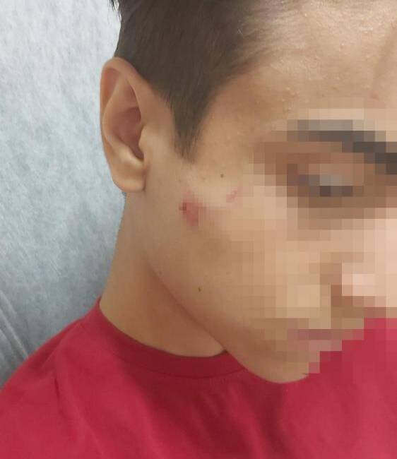 Hatay’da okuldan döndüğü esnada aynı okulda okuduğu akranı tarafından demir