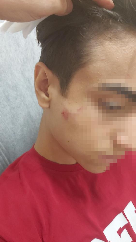 Hatay’da okuldan döndüğü esnada aynı okulda okuduğu akranı tarafından demir
