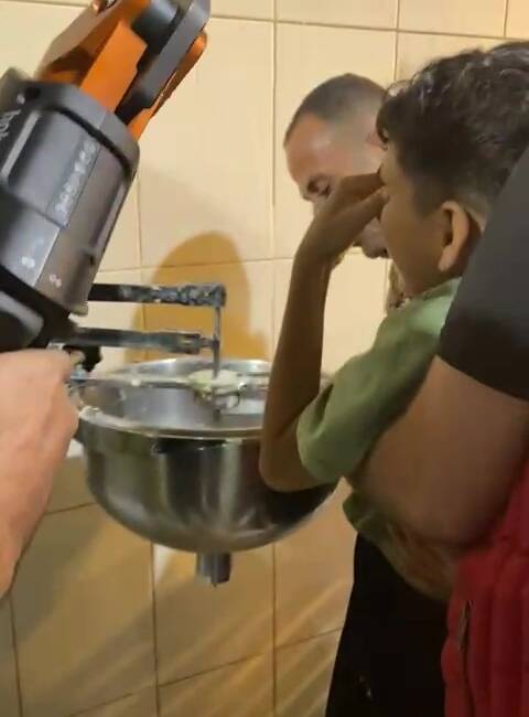 Hatay’ın İskenderun ilçesinde elini hamur karıştırma makinesine sıkıştıran küçük çocuk,