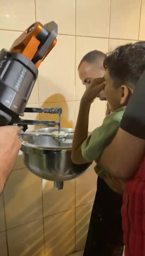 Hatay’ın İskenderun ilçesinde elini hamur karıştırma makinesine sıkıştıran küçük çocuk,