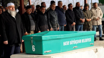 Hatay’da doğuştan yapışık kalçaları ameliyatla ayrılan ve uzun süredir sağlık