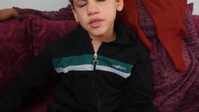 Hatay’da doğuştan katarakt nedeniyle 8 yıldır görme sorunu yaşayan Ömer